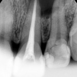 2013-06-19 초진 #21,22