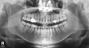 2013-06-19 초진pano#21,22