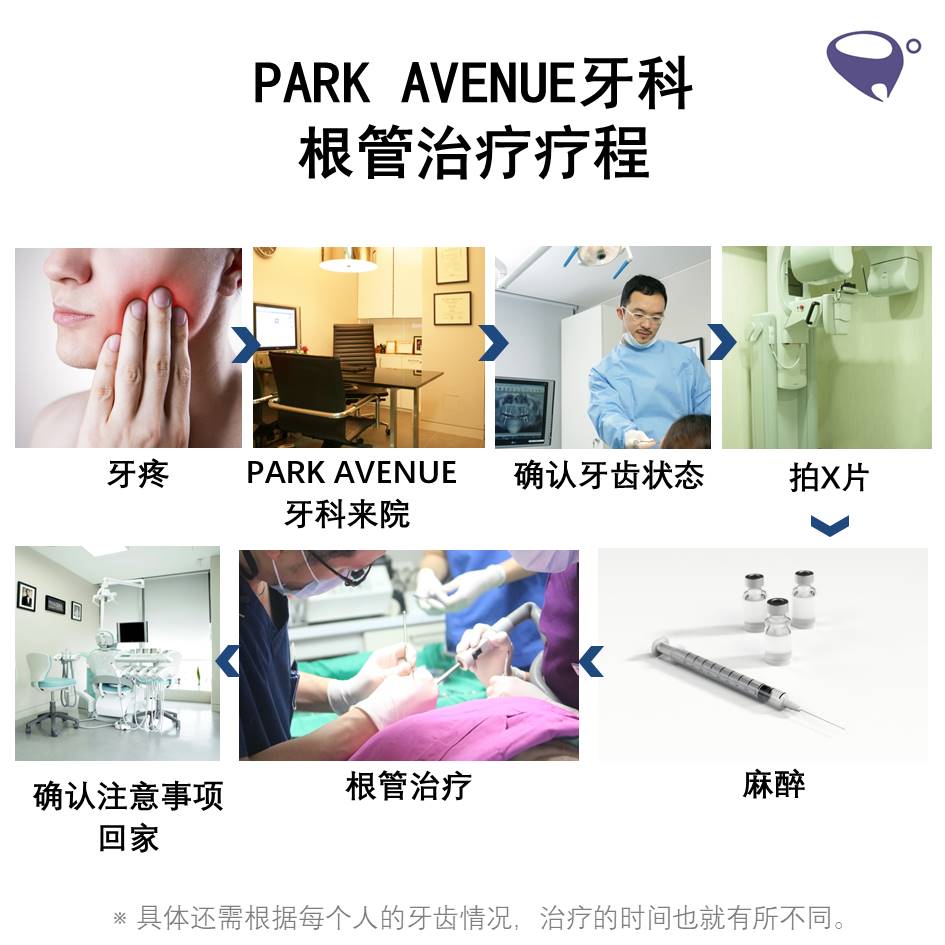 신경치료치료순서