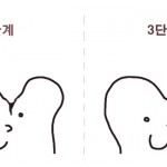 충치신경치료~ 이제는 수면마취로 편안하게!!